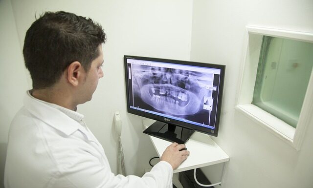 Jak mieć widoczna Żuchwę?